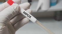 Ein Plastikröhrchen mit der Aufschrift „MPOX“. Im Röhrchen befindet sich ein Tupfer, mit dem man Abstriche machen kann.
