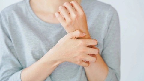 Женщина чешет свою руку.