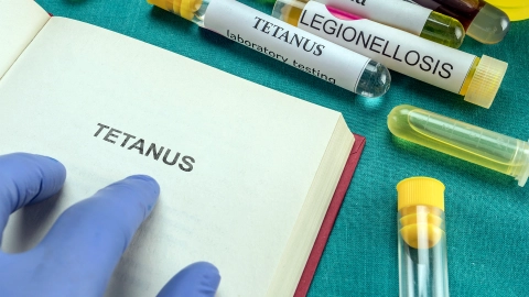 Kitap ve tetanos etiketli test tüpleri.